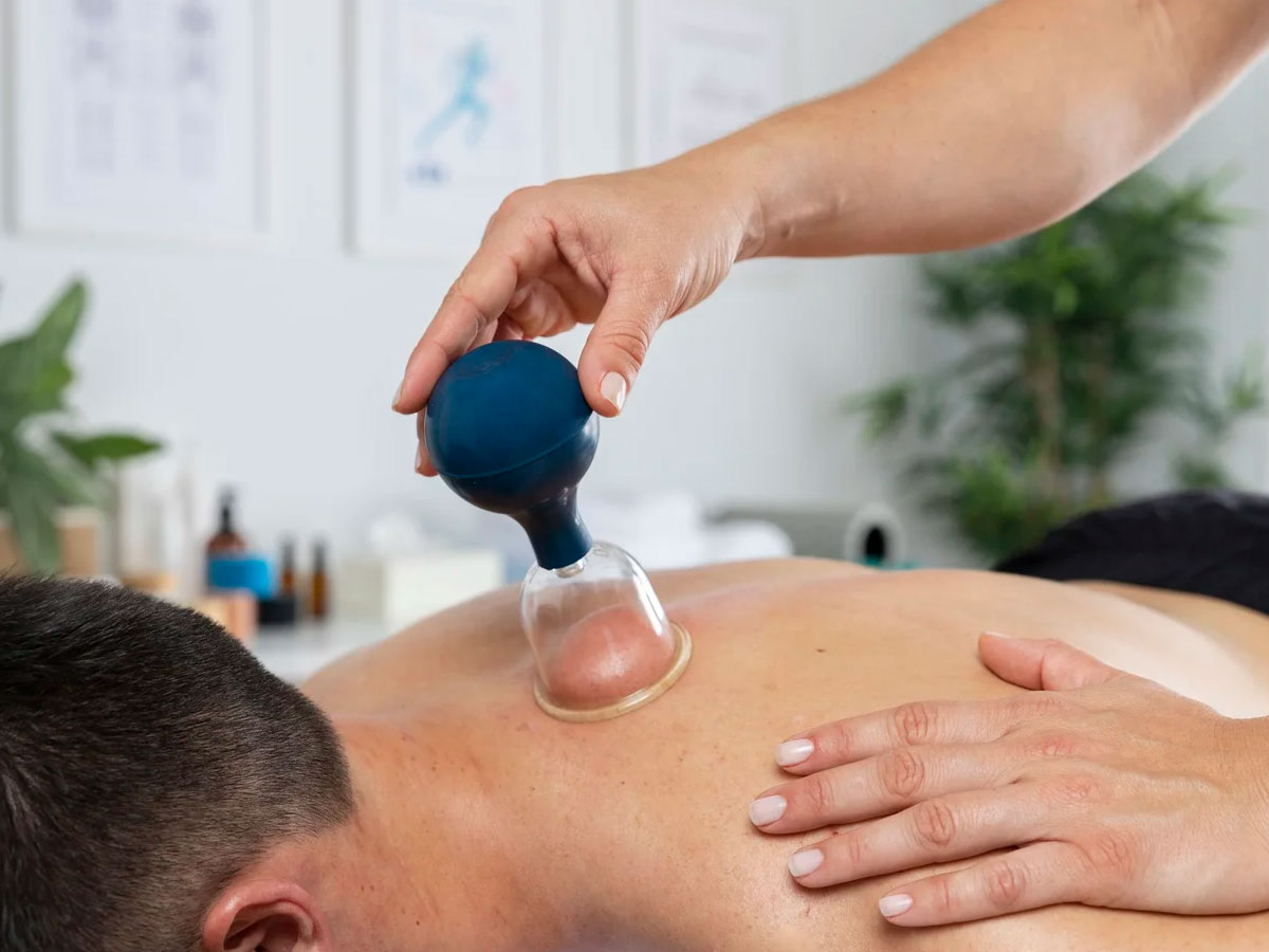 Cupping service